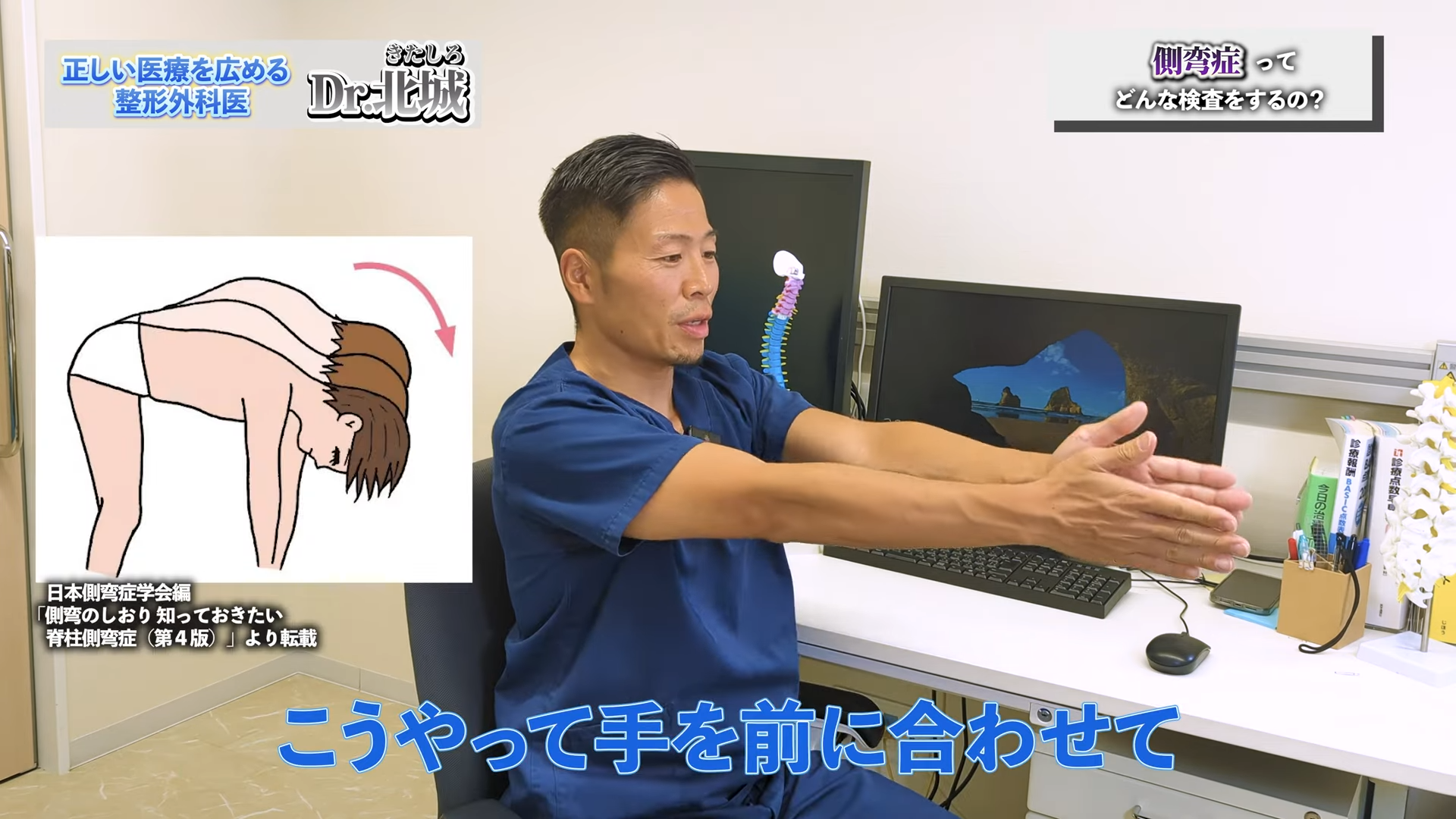 側 湾 症 整形 外科
